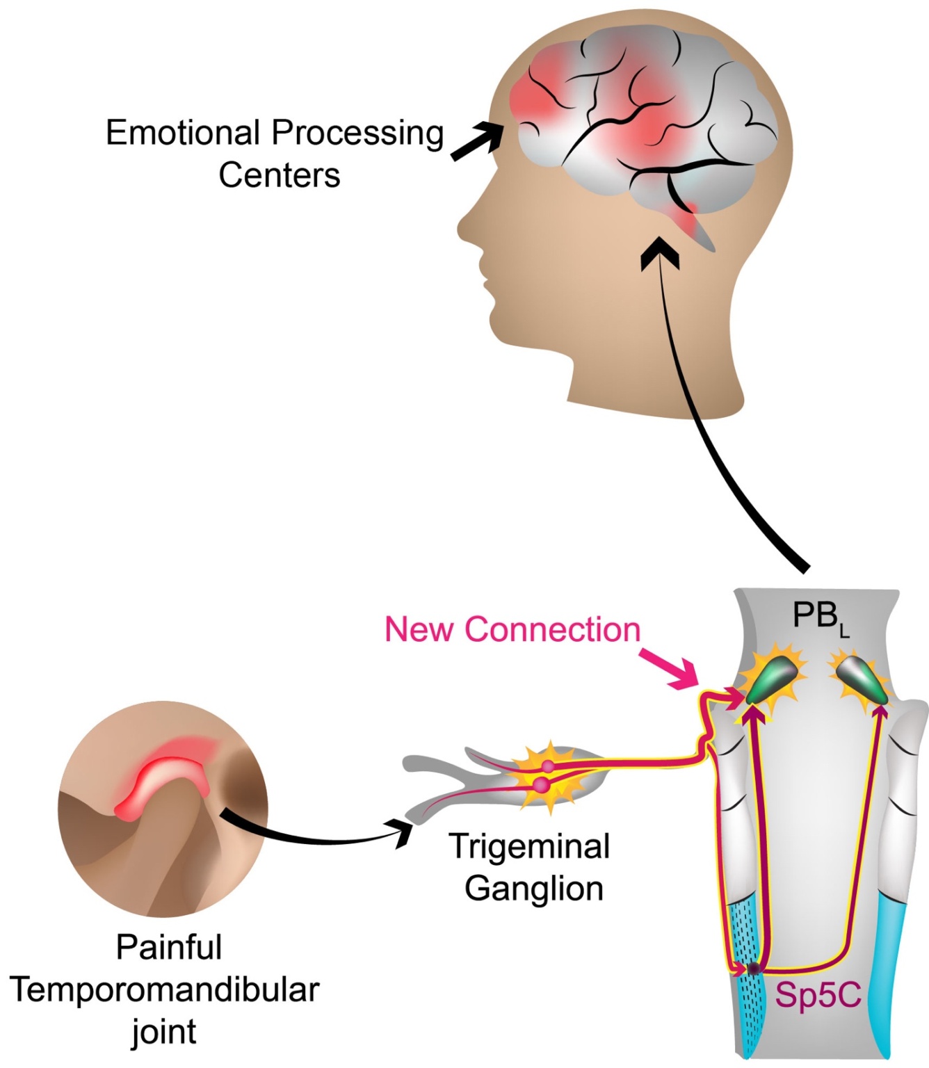 pain-in-your-head-hurts-more-than-elsewhere-in-the-body-the-tmj